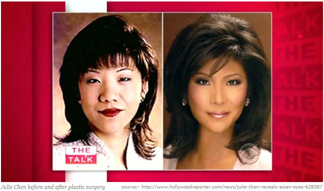 Julie Chen Eyelid Surgery