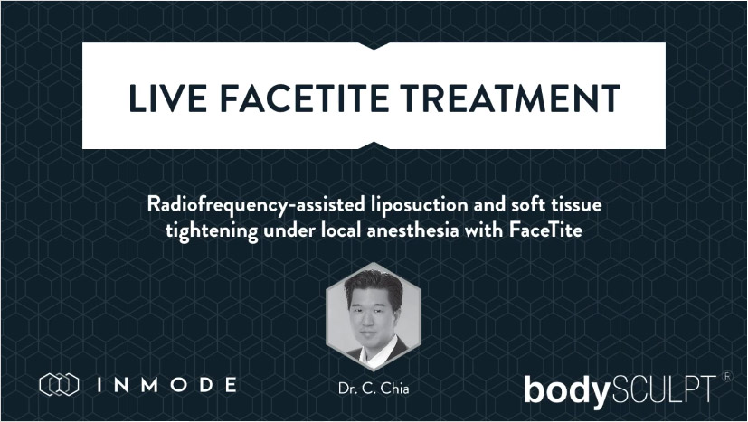 Live Facetite Treatment