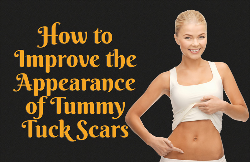 How to Improve the Appearance of Tummy Tuck Scars [infographics]
