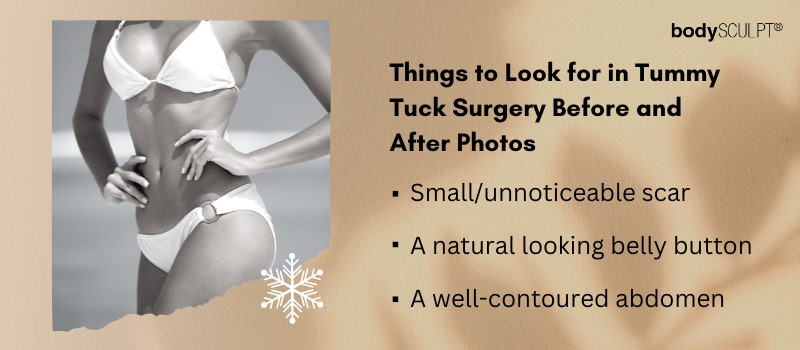 Tummy Tuck Surgery