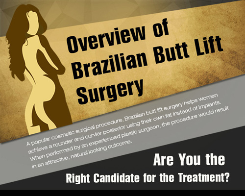 Overview of Brazilian Butt Lift Surgery