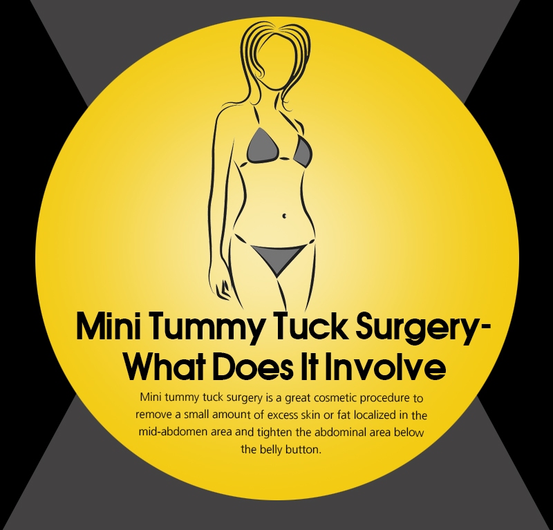 mini tummy tuck surgery involve