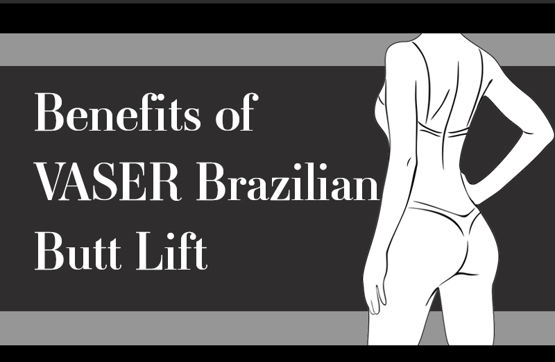 Benefits of VASER Brazilian Butt Lift NYC