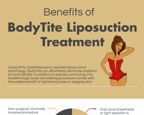 Benefits of BodyTite Liposuction Treatment