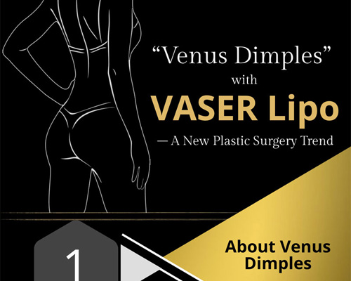 "Venus Dimples" with VASER Lipo - A New Plastic Surgery Trend