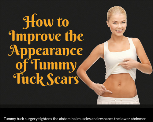 How to Improve the Appearance of Tummy Tuck Scars