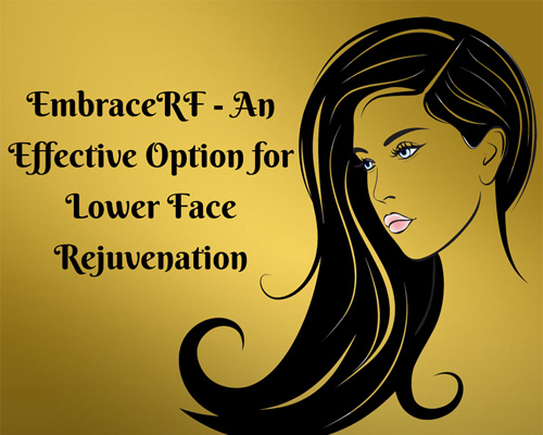 Embrace-RF - An Effective Option for Lower Face Rejuvenation