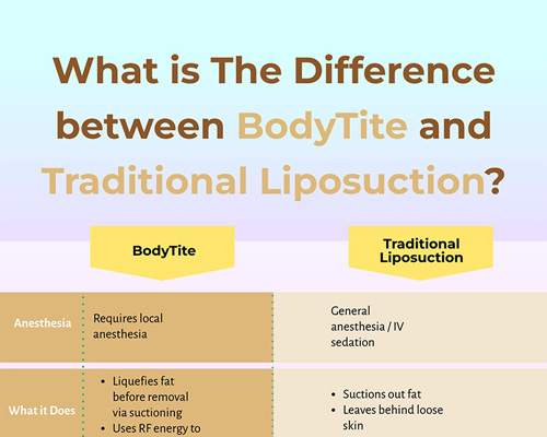 Difference between BodyTite And Traditional Liposuction