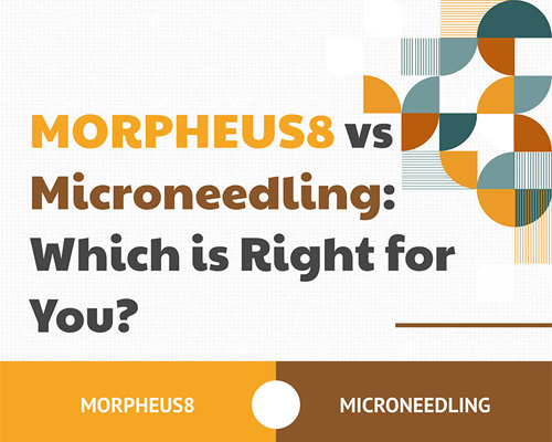 MORPHEUS8 vs Microneedling: Which is Right for You?