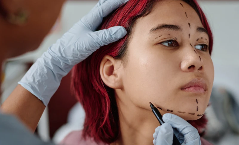 Cosmetic Surgery and the Intriguing Concept of Beauty