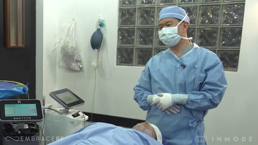 Embrace-RF Facial Rejuvenation Procedure