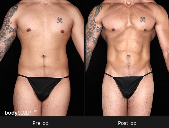 Plastic Surgery for Men in Manhattan