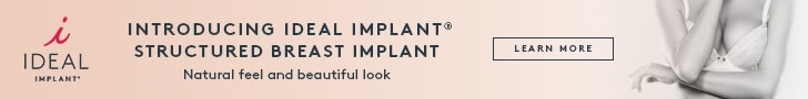 IDEAL IMPLANT