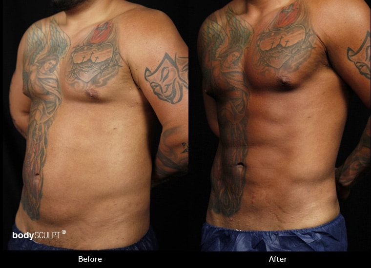 How To Reduce Love Handles Men