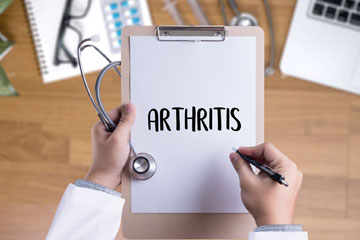 Arthritis