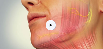 EmbraceRF Facial Rejuvenation Procedure Animated Video