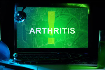 Arthritis