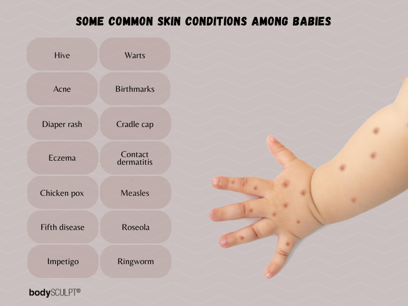 Skin Conditions