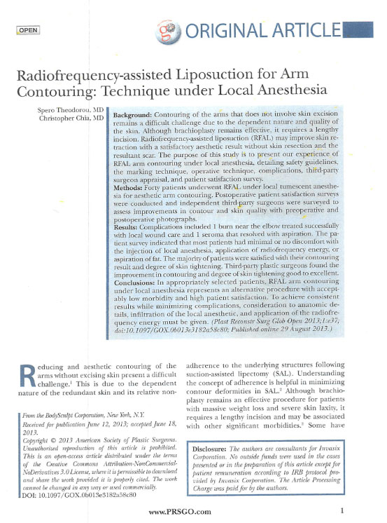 Radiofrequency-assisted Liposuction for Arm Contouring: Technique under Local Anesthesia