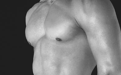 Achieving a Sculpted Physique with Male Tummy Tuck