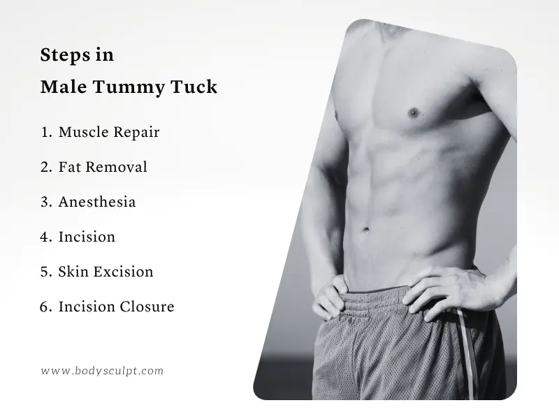 Male Tummy Tuck
