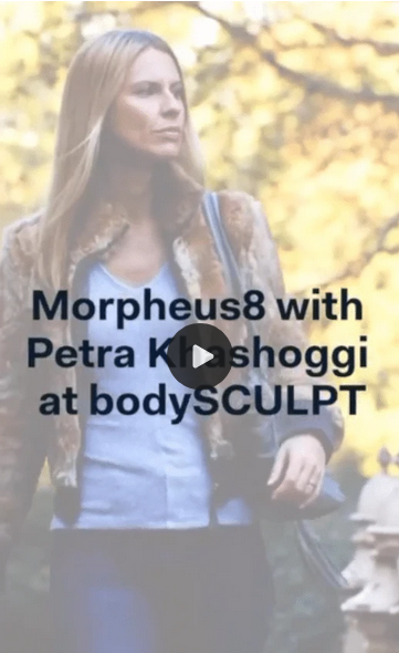 Petra Khashoggi - Morpheus8 Full Face/Neck Procedure