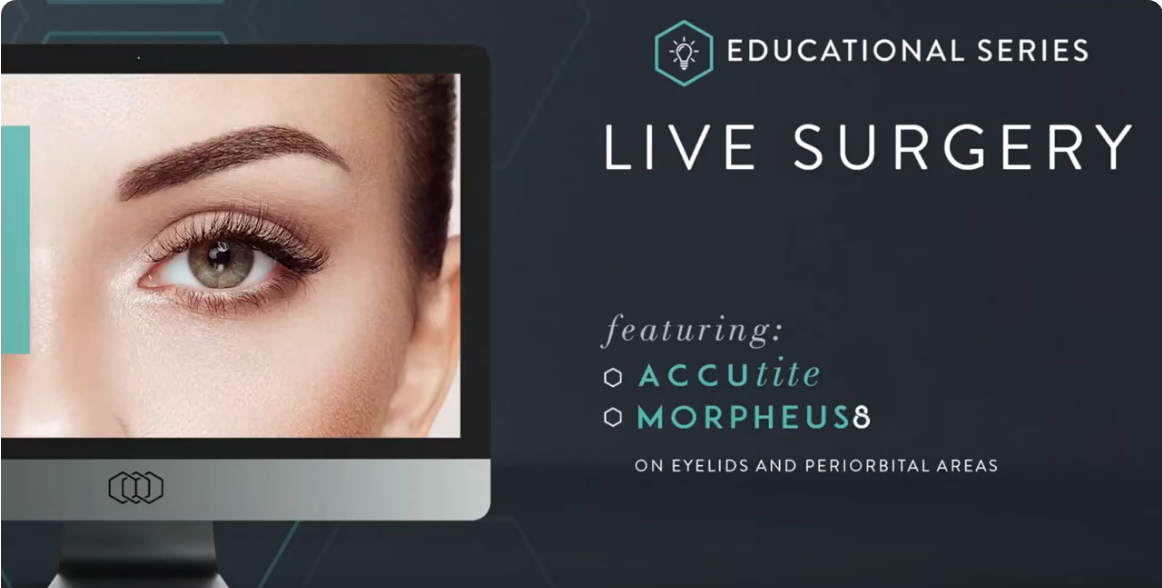 Educational Series – AccuTite and Morpheus8 on the Periorbital Area