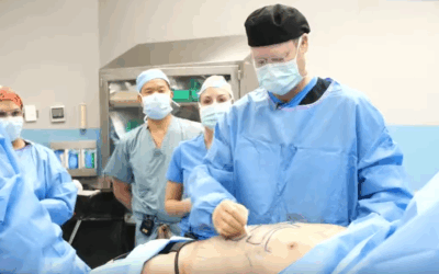 Educational Series – BodyTite and Morpheus8 Body Burst