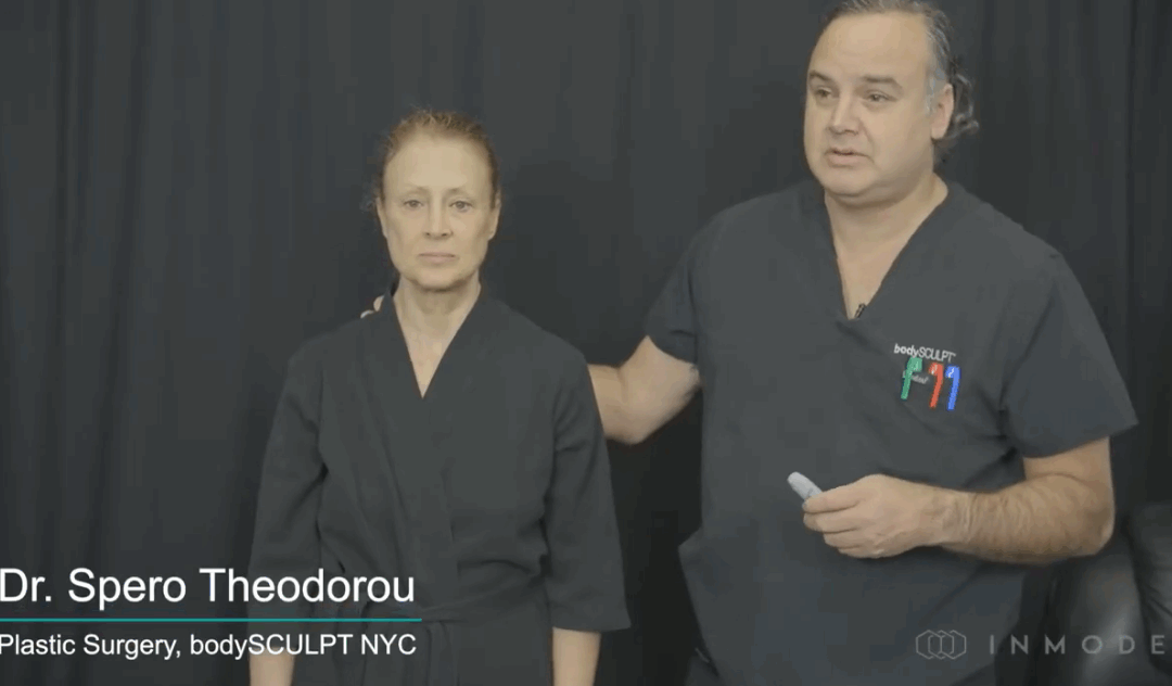 Dr. Spero Theodorou Performs AccuTite and Morpheus8 on the Face