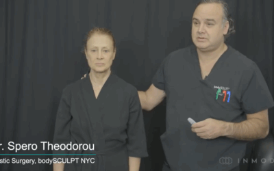 Dr. Spero Theodorou Performs AccuTite and Morpheus8 on the Face