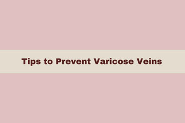 Varicose Veins