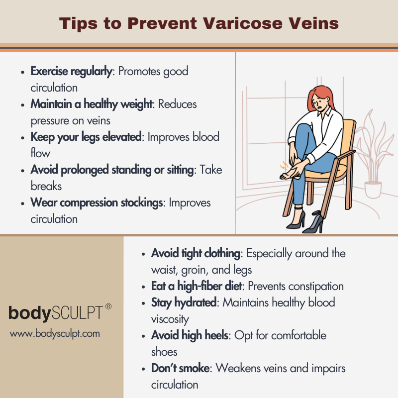 Varicose Veins