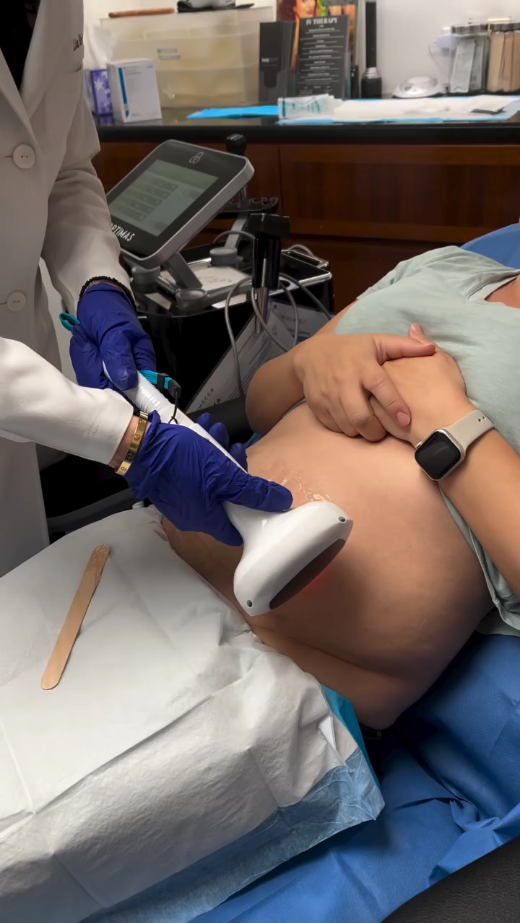 Lumecca IPL Skin Rejuvenation