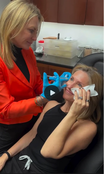Botox Injections - Patient 4