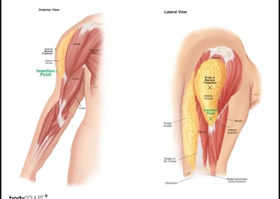 Deltoid Fat Pad - Insertion Point