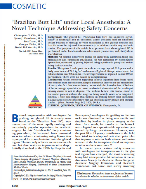 Brazilian Butt Lift” under Local Anesthesia: A Novel Technique Addressing Safety Concerns
