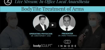 BodyTite RFAL Treatment