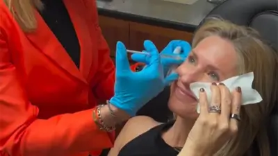 Botox Injections - Patient 4