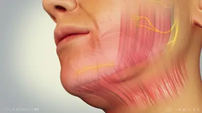 bodySCULPT® Introduces Embrace-RF – a Breakthrough Treatment in Facial and Neck Rejuvenation