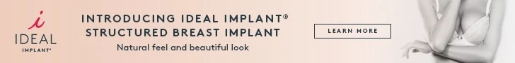 IDEAL IMPLANT IDEAL IMPLANT