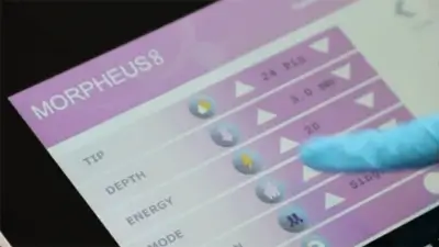 MORPHEUS8 Treatment for Face - Patient 4