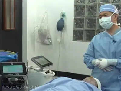 Embrace-RF - Facial Rejuvenation