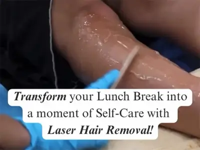 Laser Hair Removal