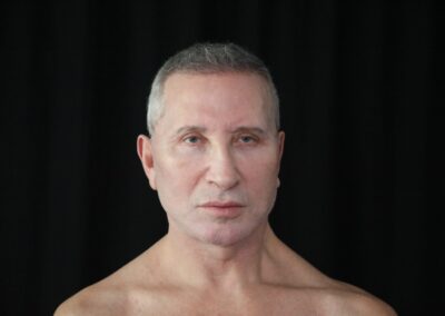 Male face lift after - front view