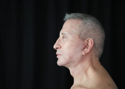 Male face lift after - side view